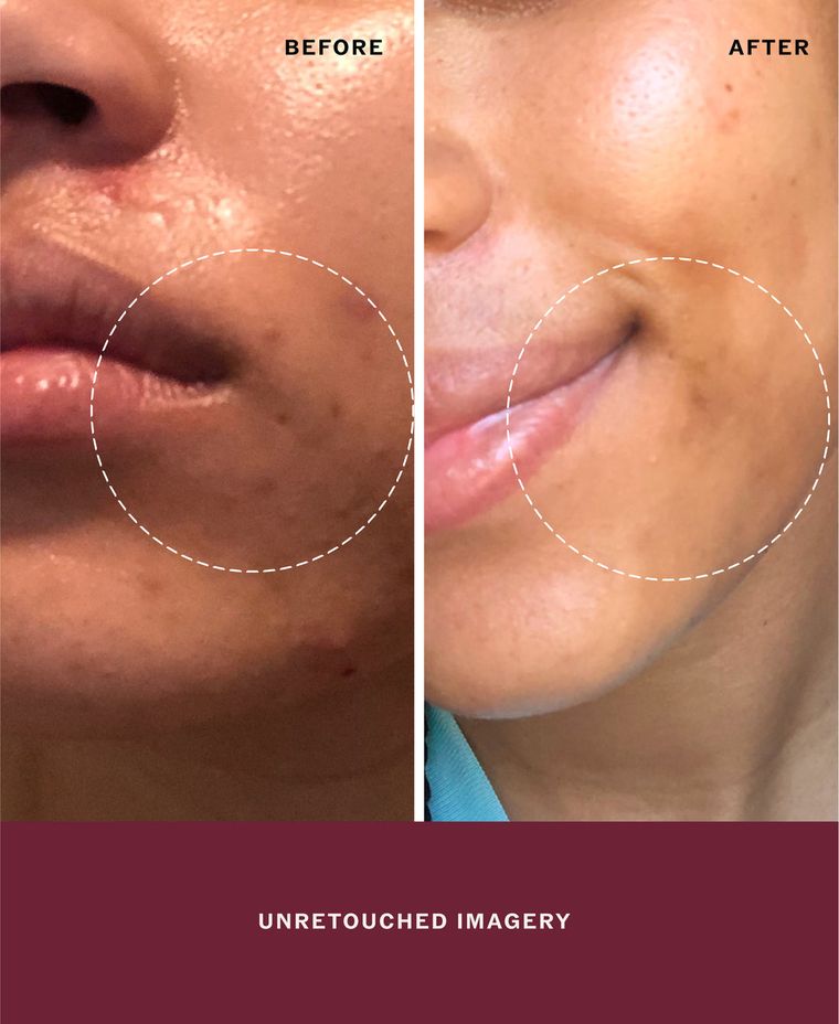 Before and after, unretouched