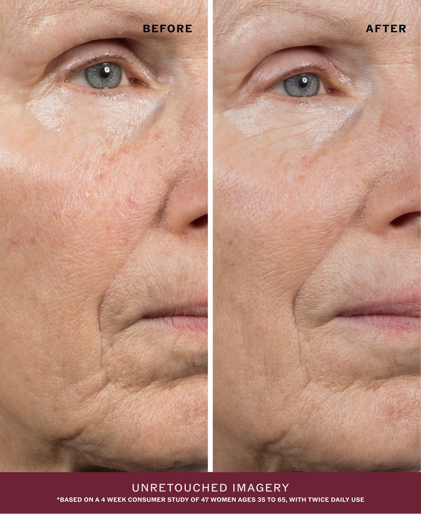 Dark Spot Ritual