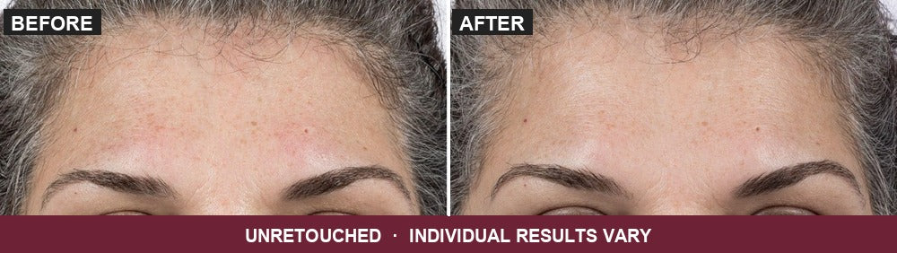 Unretouched before and after